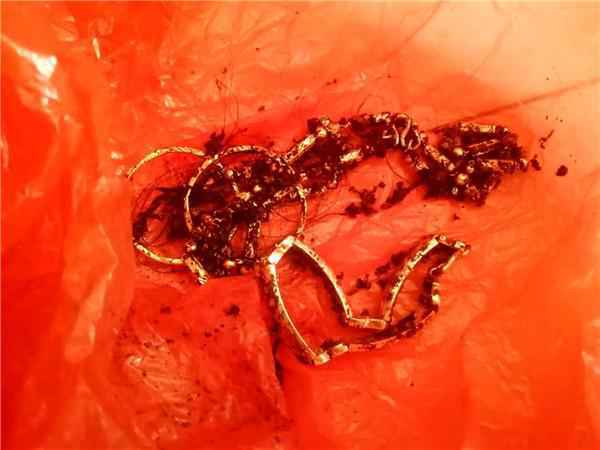 黄骅女子去世12年后尸骨被娘家人“盗去”配阴亲