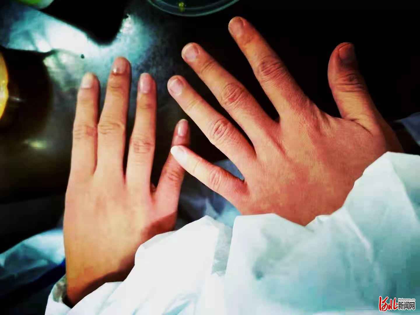 抗“疫”进行时：石家庄恒伦口腔志愿服务团队